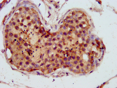 C10orf2 / PEO1 Antibody - Immunohistochemistry image at a dilution of 1:800 and staining in paraffin-embedded human testis tissue performed on a Leica BondTM system. After dewaxing and hydration, antigen retrieval was mediated by high pressure in a citrate buffer (pH 6.0) . Section was blocked with 10% normal goat serum 30min at RT. Then primary antibody (1% BSA) was incubated at 4 °C overnight. The primary is detected by a biotinylated secondary antibody and visualized using an HRP conjugated SP system.