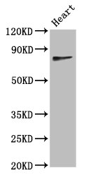 C10orf2 / PEO1 Antibody - Positive Western Blot detected in Mouse heart tissue. All lanes: TWNK antibody at 4.4 µg/ml Secondary Goat polyclonal to rabbit IgG at 1/50000 dilution. Predicted band size: 78, 67, 61 KDa. Observed band size: 78 KDa