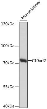 C10orf2 / PEO1 Antibody - Western blot analysis of extracts of mouse kidney, using C10orf2 antibody at 1:1000 dilution. The secondary antibody used was an HRP Goat Anti-Rabbit IgG (H+L) at 1:10000 dilution. Lysates were loaded 25ug per lane and 3% nonfat dry milk in TBST was used for blocking. An ECL Kit was used for detection and the exposure time was 30s.