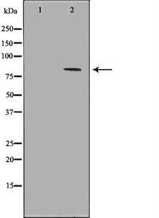 C10orf2 / PEO1 Antibody - Western blot analysis of K562 whole cells lysates using C10orf2 antibody. The lane on the left is treated with the antigen-specific peptide.