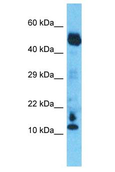 C10orf55 Antibody - C10orf55 antibody Western Blot of Esophagus Tumor. Antibody dilution: 1 ug/ml.  This image was taken for the unconjugated form of this product. Other forms have not been tested.