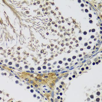 C10orf62 Antibody - Immunohistochemistry of paraffin-embedded Rat testis using C10orf62 Polyclonal Antibody at dilution of 1:100 (40x lens).