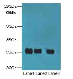 C10orf82 Antibody - Western blot. All lanes: C10orf82 antibody at 1 ug/ml. Lane 1: A431 whole cell lysate. Lane 2: HepG-2 whole cell lysate. Lane 3: Mouse thymus tissue. Secondary Goat polyclonal to Rabbit IgG at 1:10000 dilution. Predicted band size: 26 kDa. Observed band size: 26 kDa.