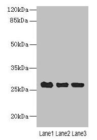 C10orf82 Antibody - Western blot All lanes: C10orf82 antibody at 1µg/ml Lane 1: A431 whole cell lysate Lane 2: HepG2 whole cell lysate Lane 3: Mouse thymus tissue Secondary Goat polyclonal to rabbit IgG at 1/10000 dilution Predicted band size: 26, 18, 13 kDa Observed band size: 26 kDa