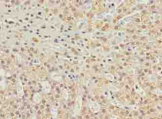 C10orf91 Antibody - Immunohistochemistry of paraffin-embedded human adrenal gland tissue using antibody at dilution of 1:100.