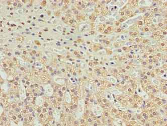 C10orf91 Antibody - Immunohistochemistry of paraffin-embedded human adrenal gland tissue using C10orf91 Antibody at dilution of 1:100