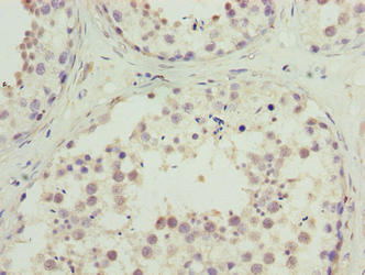 C10orf91 Antibody - Immunohistochemistry of paraffin-embedded human testis tissue using C10orf91 Antibody at dilution of 1:100