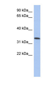 C10orf96 Antibody - C10orf96 antibody Western blot of Placenta lysate. This image was taken for the unconjugated form of this product. Other forms have not been tested.