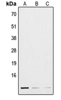 C11 / POLR3K Antibody - Western blot analysis of POLR3K expression in HepG2 (A); mouse lung (B); H9C2 (C) whole cell lysates.