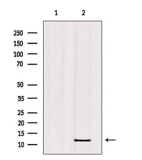 C11 / POLR3K Antibody - Western blot analysis of extracts of mouse brain tissue using RPC10 antibody. Lane 1 was treated with the blocking peptide.