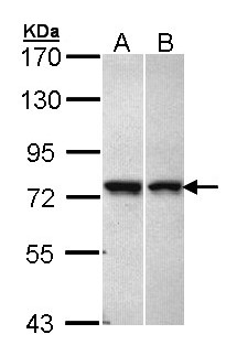 C11orf2 / Fat-Free Antibody - Sample (30 ug of whole cell lysate). A: A431 , B: Hela. 7.5% SDS PAGE. C11orf2 antibody diluted at 1:1000.
