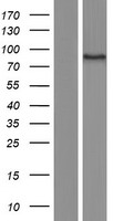 C11orf2 / Fat-Free Protein - Western validation with an anti-DDK antibody * L: Control HEK293 lysate R: Over-expression lysate
