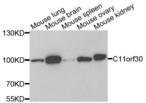 C11orf30 / EMSY Antibody - Western blot analysis of extracts of various cells.