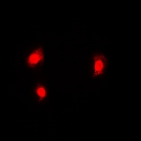 C11orf30 / EMSY Antibody - Immunofluorescent analysis of EMSY staining in HeLa cells. Formalin-fixed cells were permeabilized with 0.1% Triton X-100 in TBS for 5-10 minutes and blocked with 3% BSA-PBS for 30 minutes at room temperature. Cells were probed with the primary antibody in 3% BSA-PBS and incubated overnight at 4 deg C in a humidified chamber. Cells were washed with PBST and incubated with a DyLight 594-conjugated secondary antibody (red) in PBS at room temperature in the dark.