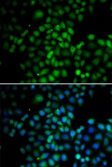 C11orf30 / EMSY Antibody - Immunofluorescence analysis of HeLa cells using C11orf30 antibody. Blue: DAPI for nuclear staining.