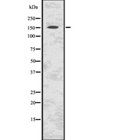 C11orf30 / EMSY Antibody - Western blot analysis of C11orf30 using K562 whole lysates.