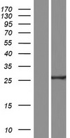 C11orf40 Protein - Western validation with an anti-DDK antibody * L: Control HEK293 lysate R: Over-expression lysate