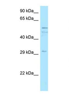 C11orf42 Antibody - C11orf42 antibody Western blot of MCF7 Cell lysate. Antibody concentration 1 ug/ml.  This image was taken for the unconjugated form of this product. Other forms have not been tested.