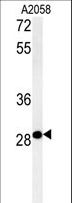 C11orf46 Antibody - C11orf46 Antibody western blot of A2058 cell line lysates (35 ug/lane). The C11orf46 antibody detected the C11orf46 protein (arrow).
