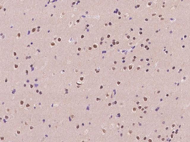 C11orf46 Antibody - Immunochemical staining of human ARL14EP in human brain with rabbit polyclonal antibody at 1:100 dilution, formalin-fixed paraffin embedded sections.