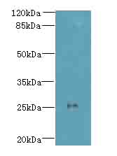 C11orf53 Antibody - Western blot. All lanes: C11orf53 antibody at 0.8 ug/ml+Mos- gonadal tissue Goat polyclonal to rabbit at 1:10000 dilution. Predicted band size: 25 kDa. Observed band size: 25 kDa.