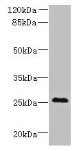 C11orf53 Antibody - Western blot All lanes: C11orf53 antibody at 0.8µg/ml + Mouse gonadal tissue Secondary Goat polyclonal to rabbit IgG at 1/10000 dilution Predicted band size: 25 kDa Observed band size: 25 kDa