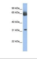 C11orf54 Antibody - Fetal muscle lysate. Antibody concentration: 1.0 ug/ml. Gel concentration: 12%.  This image was taken for the unconjugated form of this product. Other forms have not been tested.