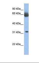 C11orf54 Antibody - Fetal muscle lysate. Antibody concentration: 1.0 ug/ml. Gel concentration: 12%.  This image was taken for the unconjugated form of this product. Other forms have not been tested.