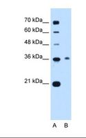 C11orf54 Antibody - Lane A: Marker. Lane B: Jurkat cell lysate. Antibody concentration: 0.5 ug/ml. Gel concentration: 12%.  This image was taken for the unconjugated form of this product. Other forms have not been tested.