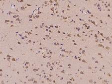 C11orf58 Antibody - Immunochemical staining of human C11orf58 in human brain with rabbit polyclonal antibody at 1:100 dilution, formalin-fixed paraffin embedded sections.