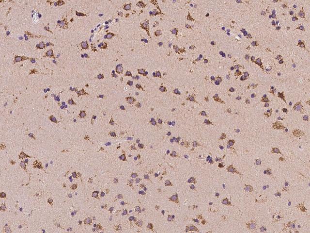C11orf58 Antibody - Immunochemical staining of human C11orf58 in human brain with rabbit polyclonal antibody at 1:100 dilution, formalin-fixed paraffin embedded sections.