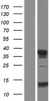 C11orf63 Protein - Western validation with an anti-DDK antibody * L: Control HEK293 lysate R: Over-expression lysate