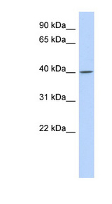 C11orf65 Antibody - C11orf65 antibody Western blot of MCF7 cell lysate. This image was taken for the unconjugated form of this product. Other forms have not been tested.