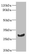 C11orf68 Antibody - Western blot All lanes: C11orf68 antibody at 3µg/ml + Mouse liver tissue Secondary Goat polyclonal to rabbit IgG at 1/10000 dilution Predicted band size: 28, 32 kDa Observed band size: 28 kDa