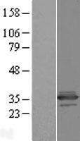 C11orf68 Protein - Western validation with an anti-DDK antibody * L: Control HEK293 lysate R: Over-expression lysate