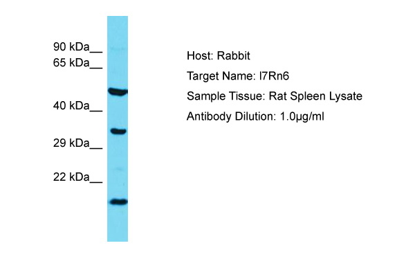 C11orf73 Antibody -  This image was taken for the unconjugated form of this product. Other forms have not been tested.
