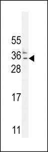 C11orf73 Antibody - CK073 Antibody western blot of MDA-MB435 cell line lysates (35 ug/lane). The CK073 antibody detected the CK073 protein (arrow).