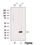 C11orf73 Antibody - Western blot analysis of extracts of HeLa cells using Hikeshi antibody. The lane on the left was treated with blocking peptide.