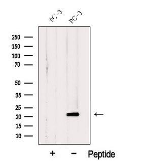 C11orf73 Antibody - Western blot analysis of extracts of HeLa cells using Hikeshi antibody. The lane on the left was treated with blocking peptide.
