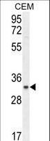 C11orf74 Antibody - C11orf74 Antibody western blot of CEM cell line lysates (35 ug/lane). The C11orf74 antibody detected the C11orf74 protein (arrow).