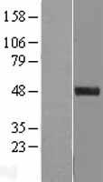 C11orf84 Protein - Western validation with an anti-DDK antibody * L: Control HEK293 lysate R: Over-expression lysate