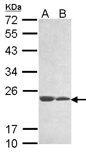 C11orf85 Antibody - Sample (30 ug of whole cell lysate). A:293T, B: A431 . 12% SDS PAGE. C11orf85 antibody diluted at 1:1000.