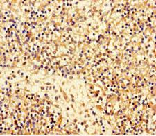 C11orf85 Antibody - Immunohistochemistry of paraffin-embedded human spleen tissue using MAJIN Antibody at dilution of 1:100