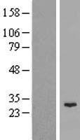 C11orf85 Protein - Western validation with an anti-DDK antibody * L: Control HEK293 lysate R: Over-expression lysate