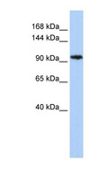 C11orf9 / MRF Antibody - C11orf9 antibody Western blot of MCF7 cell lysate. This image was taken for the unconjugated form of this product. Other forms have not been tested.