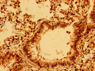 C11orf9 / MRF Antibody - Immunohistochemistry image of paraffin-embedded human lung tissue at a dilution of 1:100