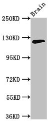 C11orf9 / MRF Antibody - Positive Western Blot detected in Mouse brain tissue. All lanes: MYRF antibody at 3.2 µg/ml Secondary Goat polyclonal to rabbit IgG at 1/50000 dilution. Predicted band size: 125, 121 KDa. Observed band size: 125 KDa