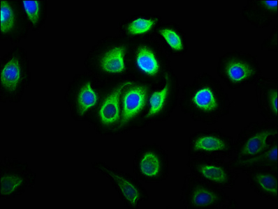 C11orf9 / MRF Antibody - Immunofluorescence staining of A549 cells with MYRF Antibody at 1:133, counter-stained with DAPI. The cells were fixed in 4% formaldehyde, permeabilized using 0.2% Triton X-100 and blocked in 10% normal Goat Serum. The cells were then incubated with the antibody overnight at 4°C. The secondary antibody was Alexa Fluor 488-congugated AffiniPure Goat Anti-Rabbit IgG(H+L).