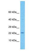 C11orf91 Antibody - C11orf91 antibody Western Blot of Jurkat. Antibody dilution: 1 ug/ml.  This image was taken for the unconjugated form of this product. Other forms have not been tested.