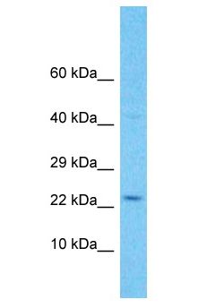 C11orf91 Antibody - C11orf91 antibody Western Blot of Jurkat. Antibody dilution: 1 ug/ml.  This image was taken for the unconjugated form of this product. Other forms have not been tested.